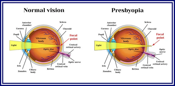 Why we use reading glasses